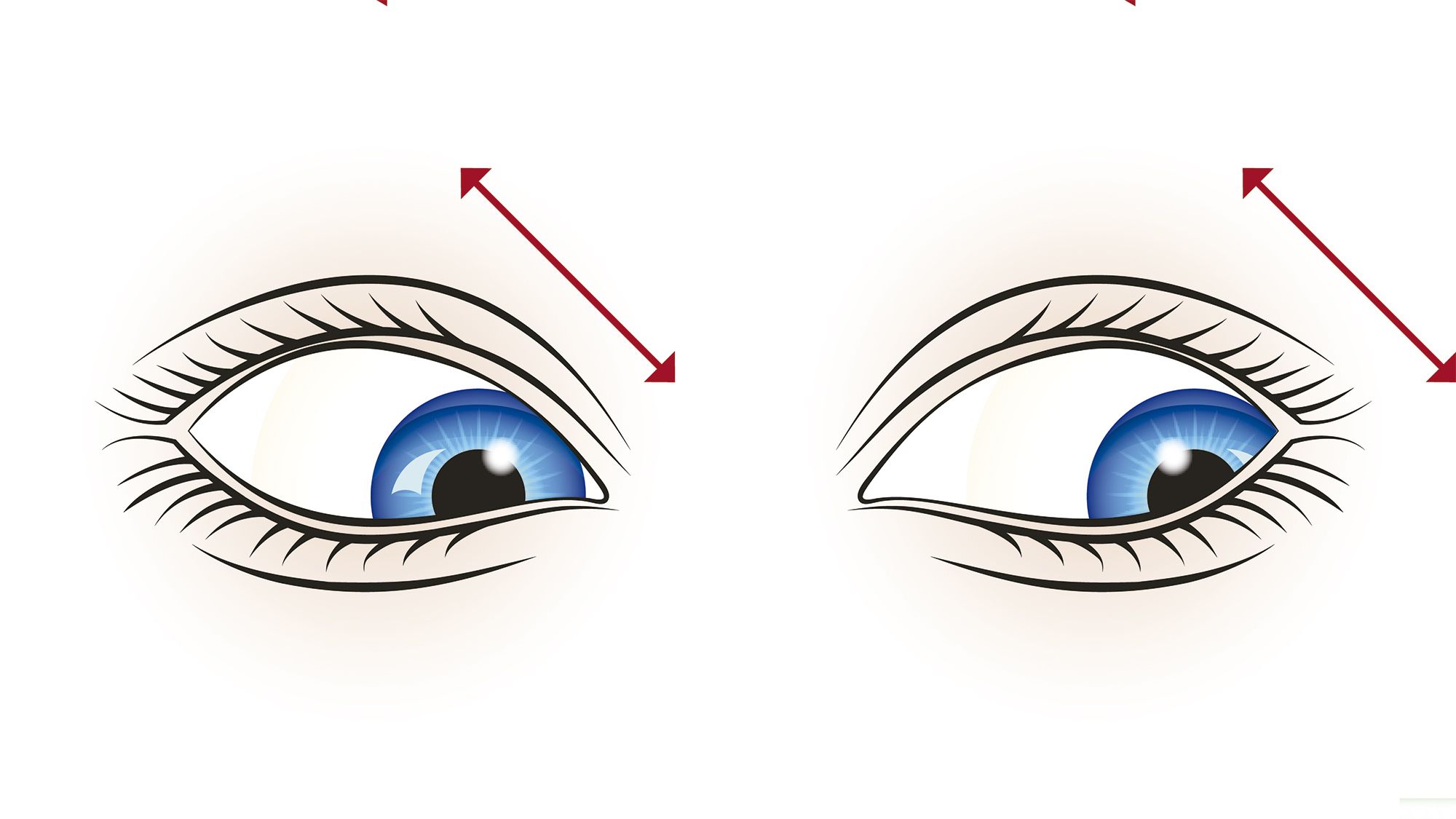 exercices de vue