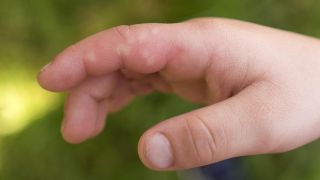 Quels sont les bienfaits de l'ortie?