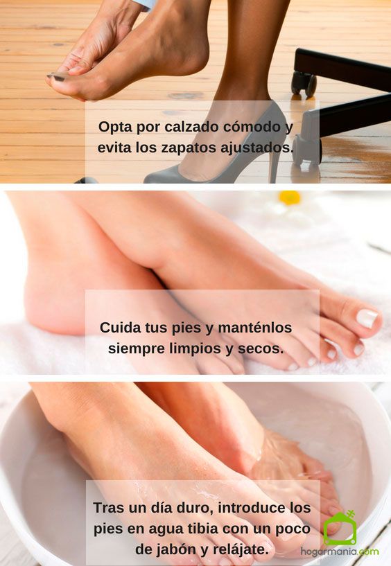 Conseils pour éviter les cors et les callosités sur les pieds.